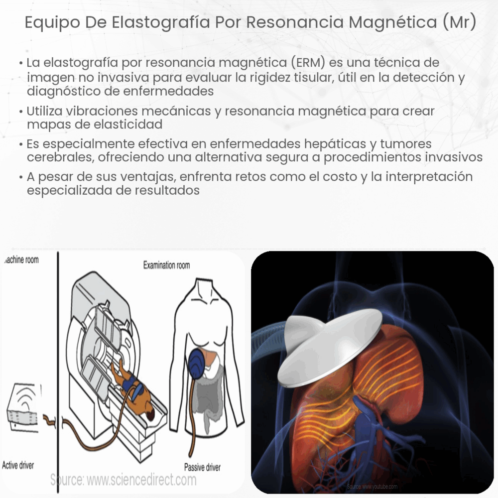 Equipo de elastografía por resonancia magnética (MR)