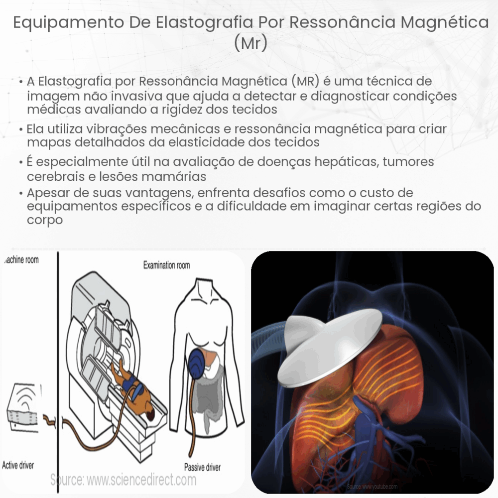 Equipamento de elastografia por ressonância magnética (MR)