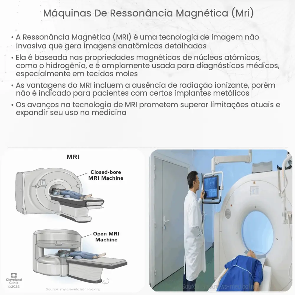 Máquinas de Ressonância Magnética (MRI)