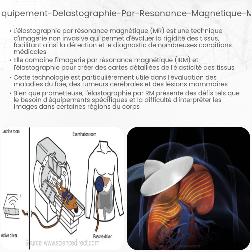 Équipement d'élastographie par résonance magnétique (MR)