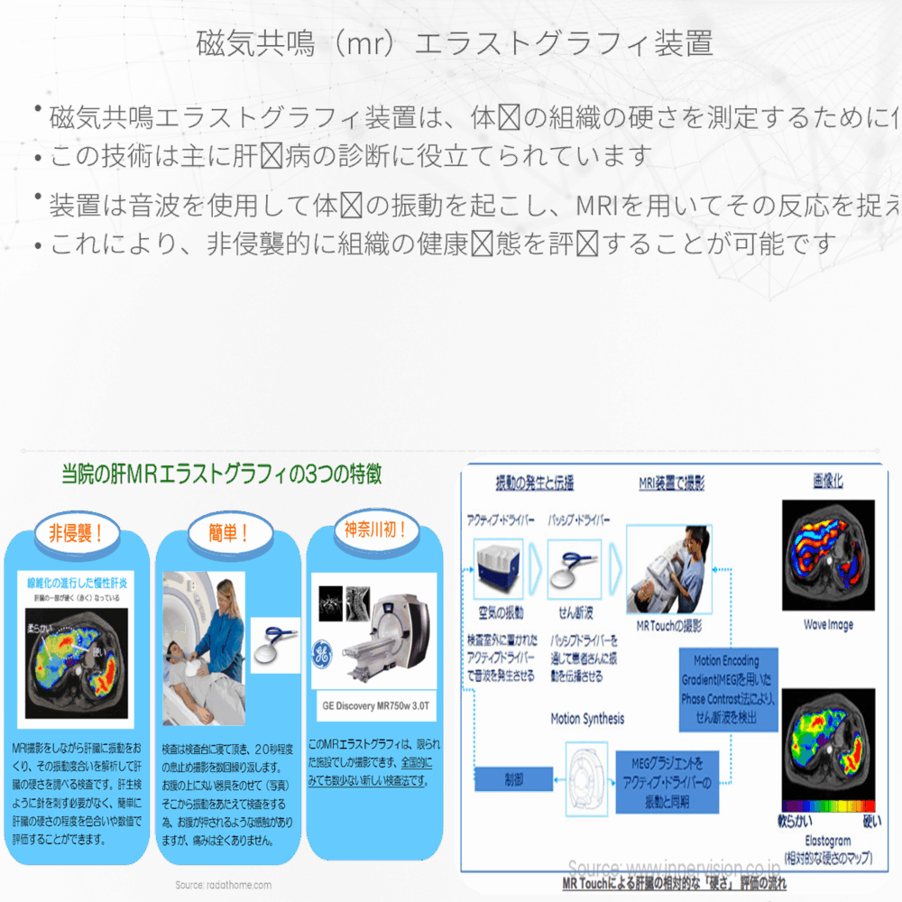 磁気共鳴（MR）エラストグラフィ装置
